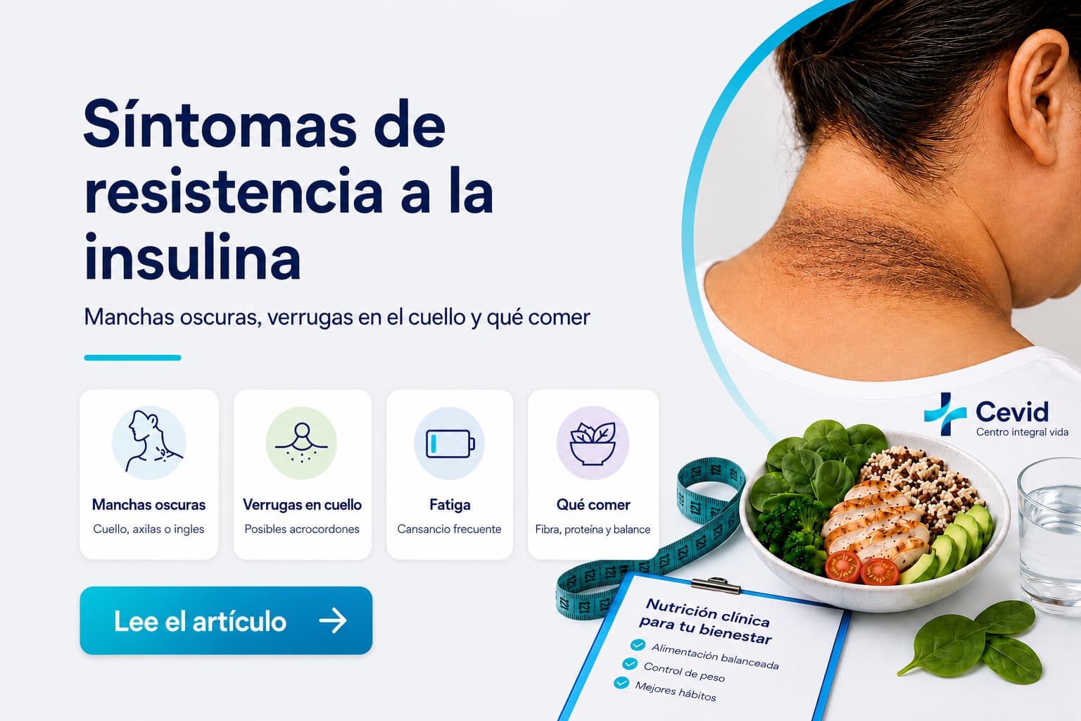 Síntomas de resistencia a la insulina: manchas, verrugas en el cuello y qué comer